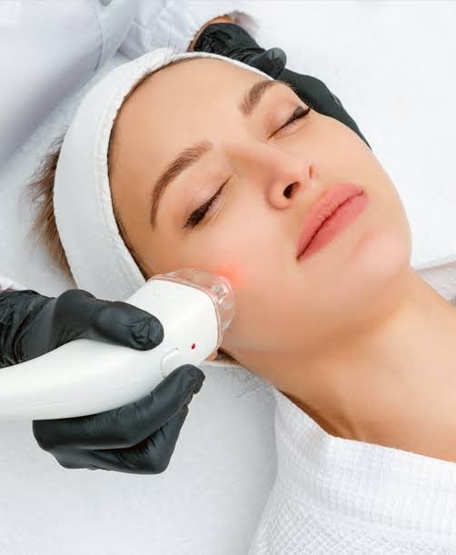 Laser Treatment Tips